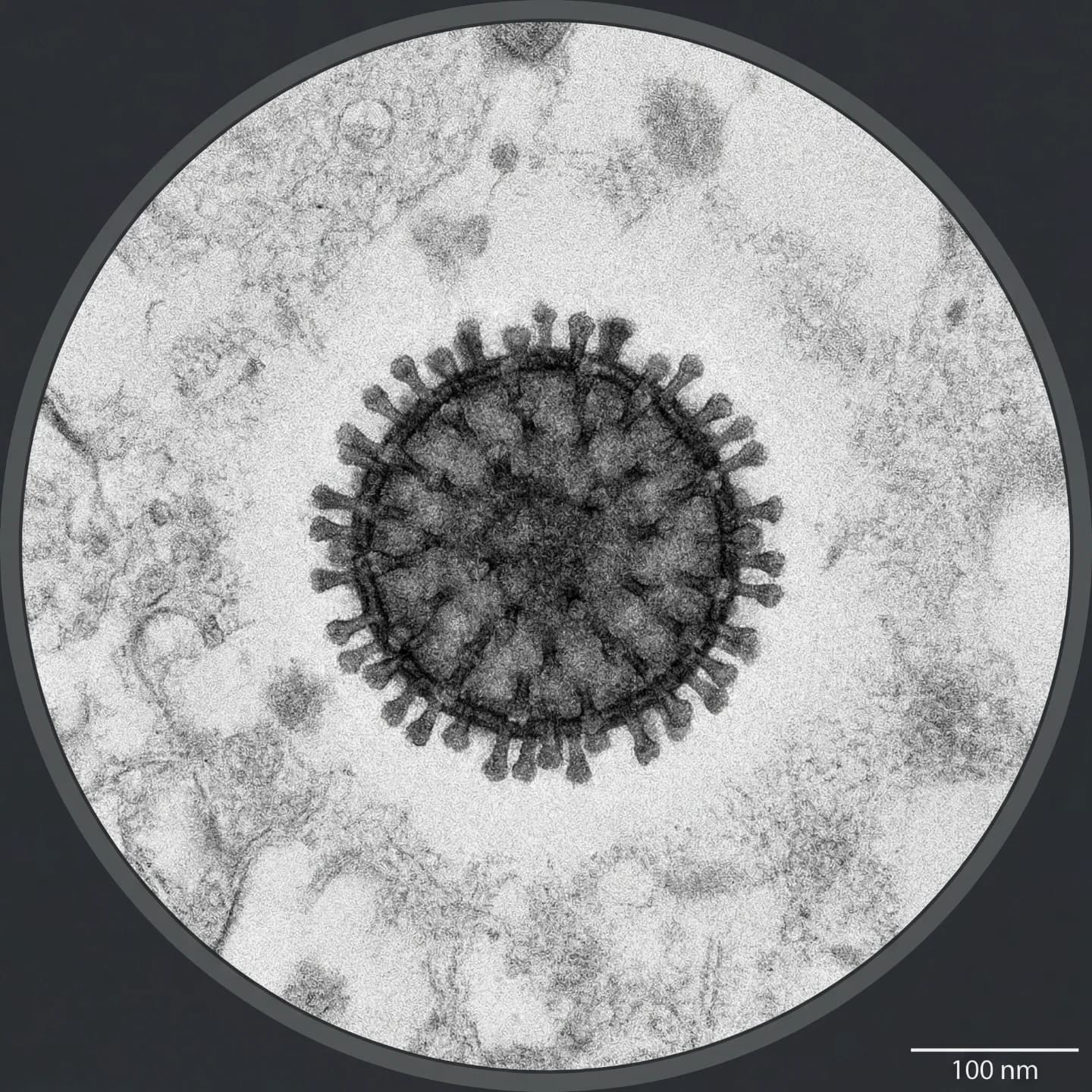 Influenza Virus (Influenzavirus A, B, C, D)