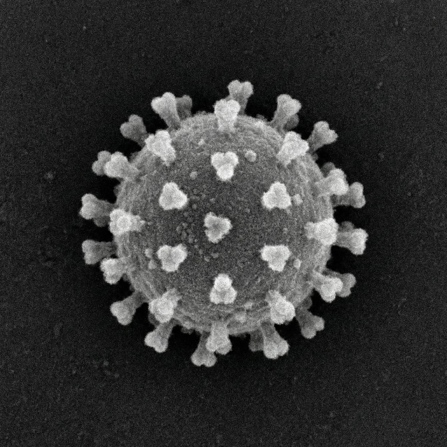SARS-CoV-2 (Severe acute respiratory syndrome-related coronavirus 2)
