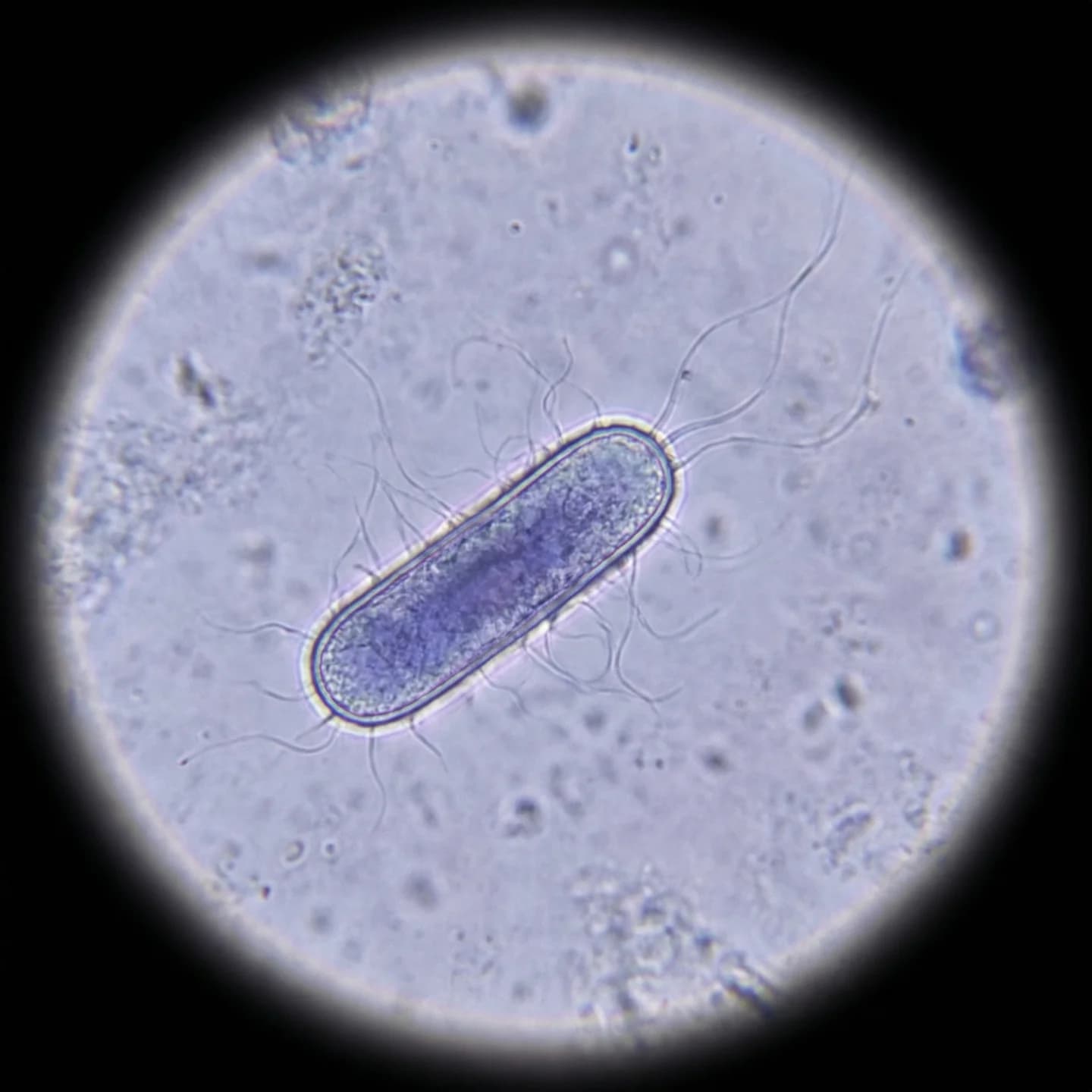 Escherichia coli (Escherichia coli)