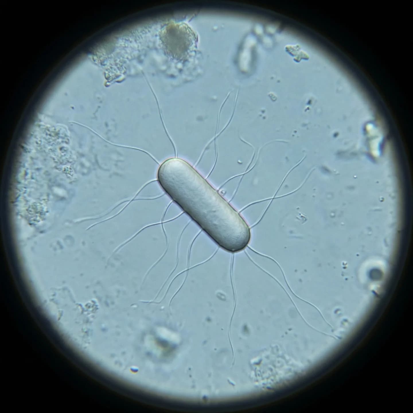 Escherichia coli 5