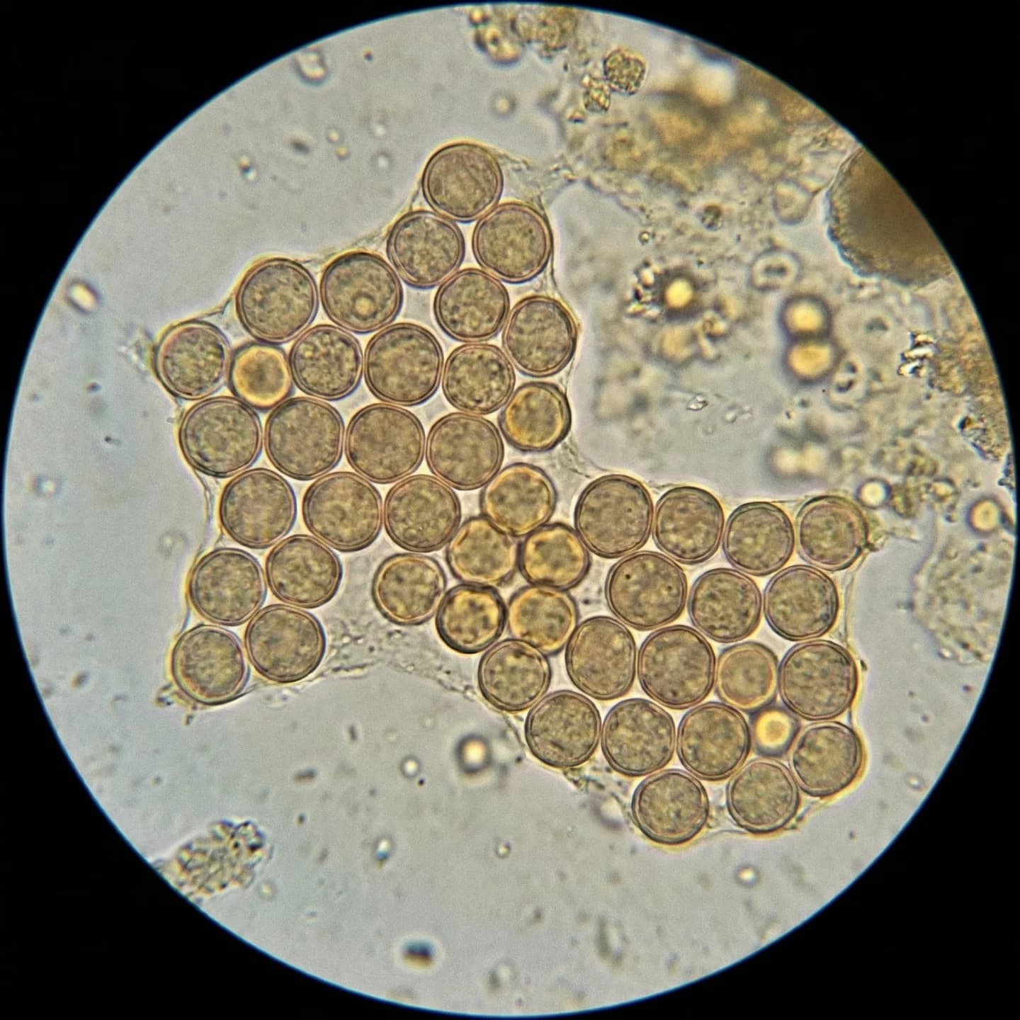 Staphylococcus aureus 4