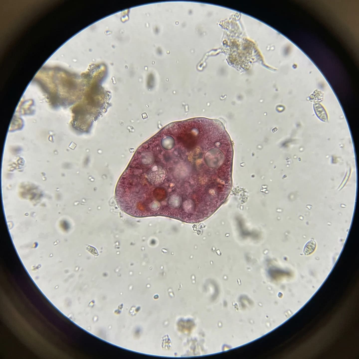 Halophilic Archaea (Haloarchaea) 2