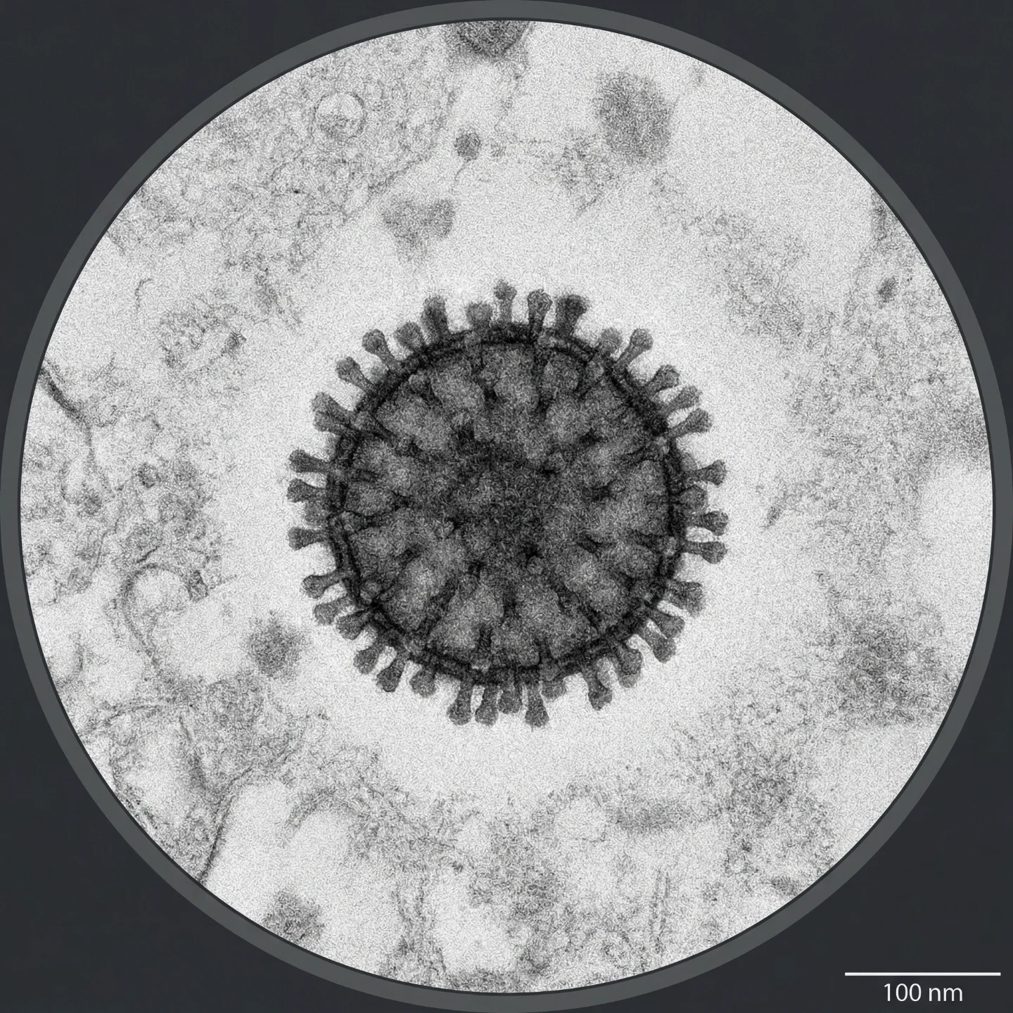 인플루엔자 바이러스 (Influenzavirus A, B, C, D)