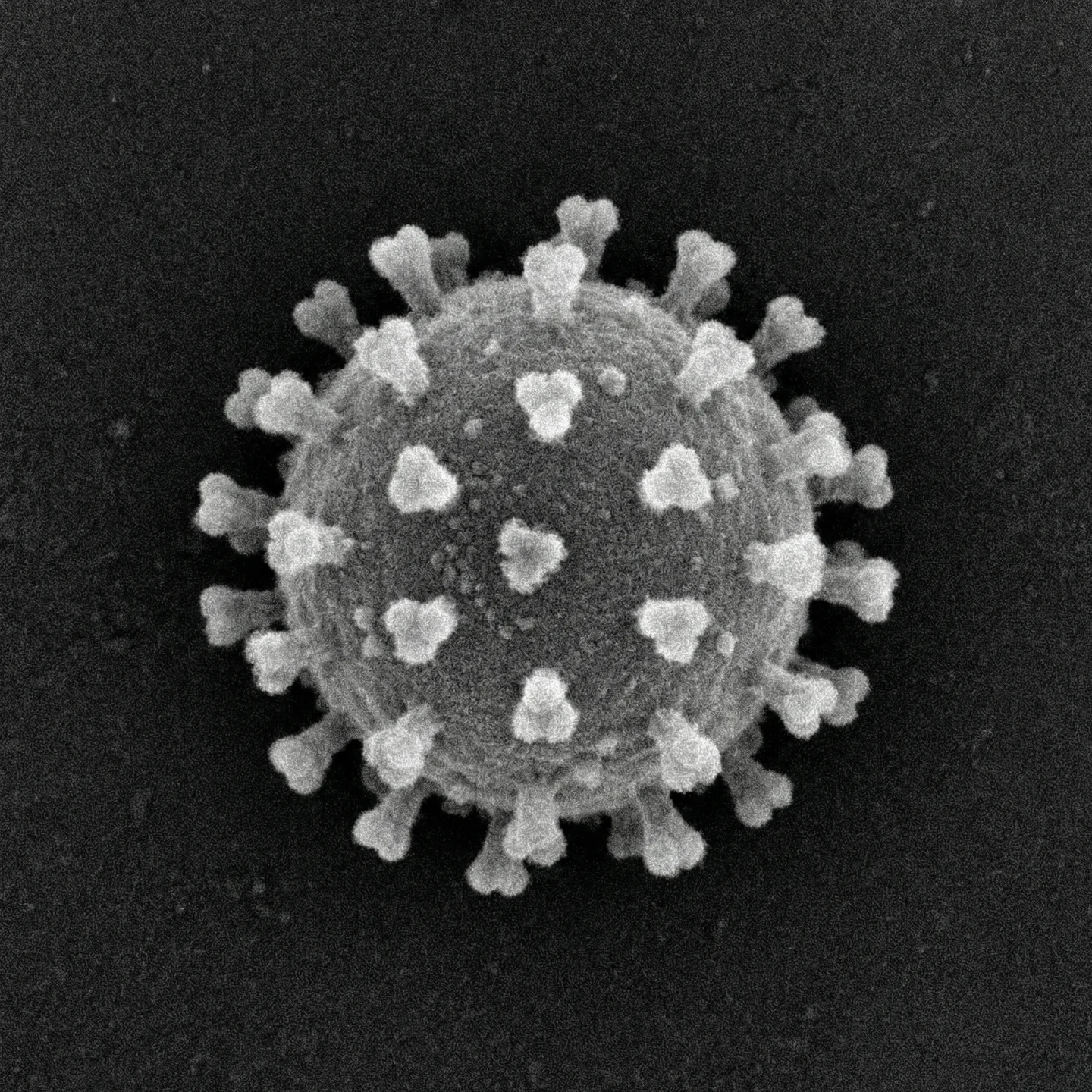 사스코로나바이러스-2 (Severe acute respiratory syndrome-related coronavirus 2)