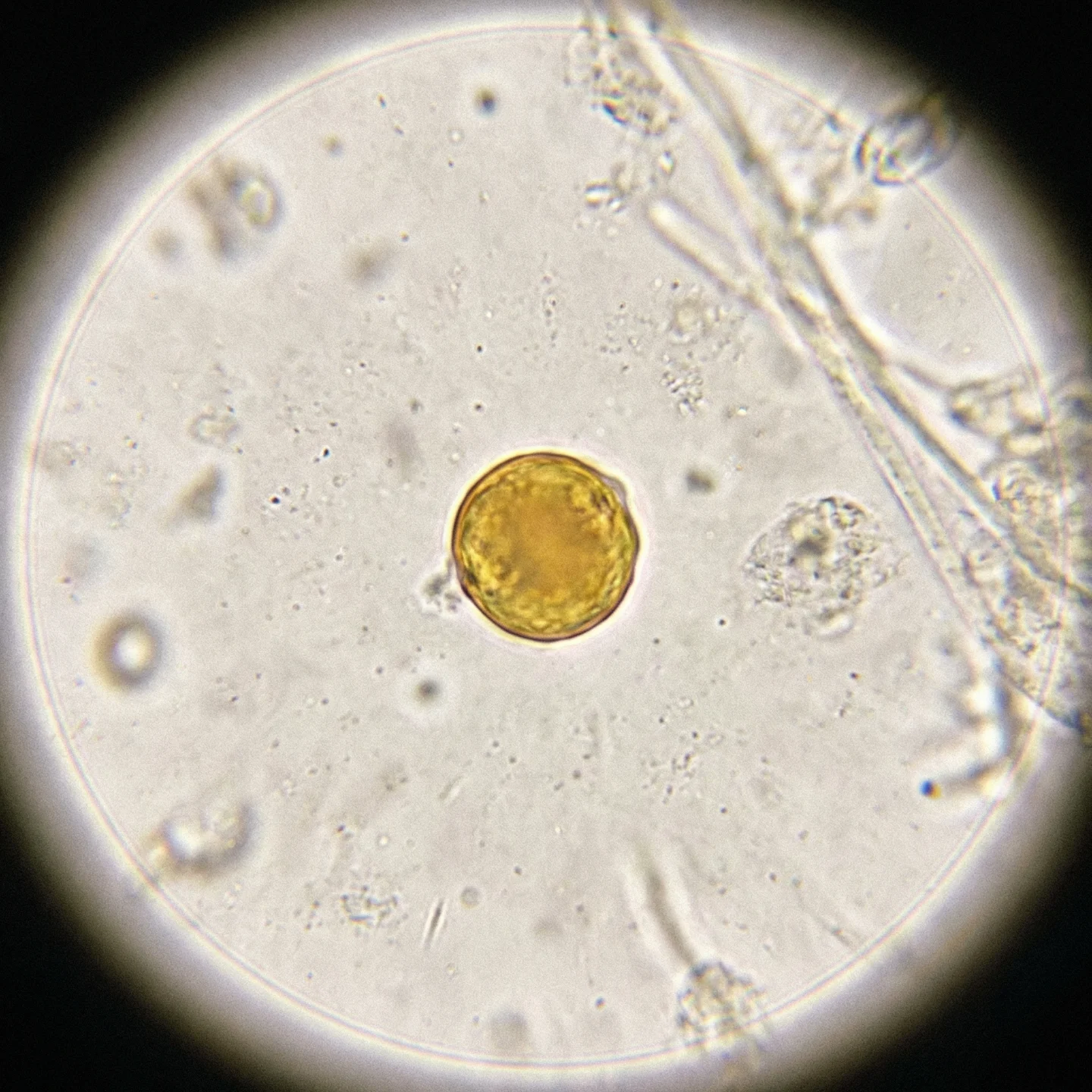 황색포도상구균 (Staphylococcus aureus)