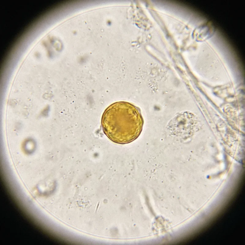 황색포도상구균 (Staphylococcus aureus) — 세균 미생물 일러스트 | DinoLifePedia
