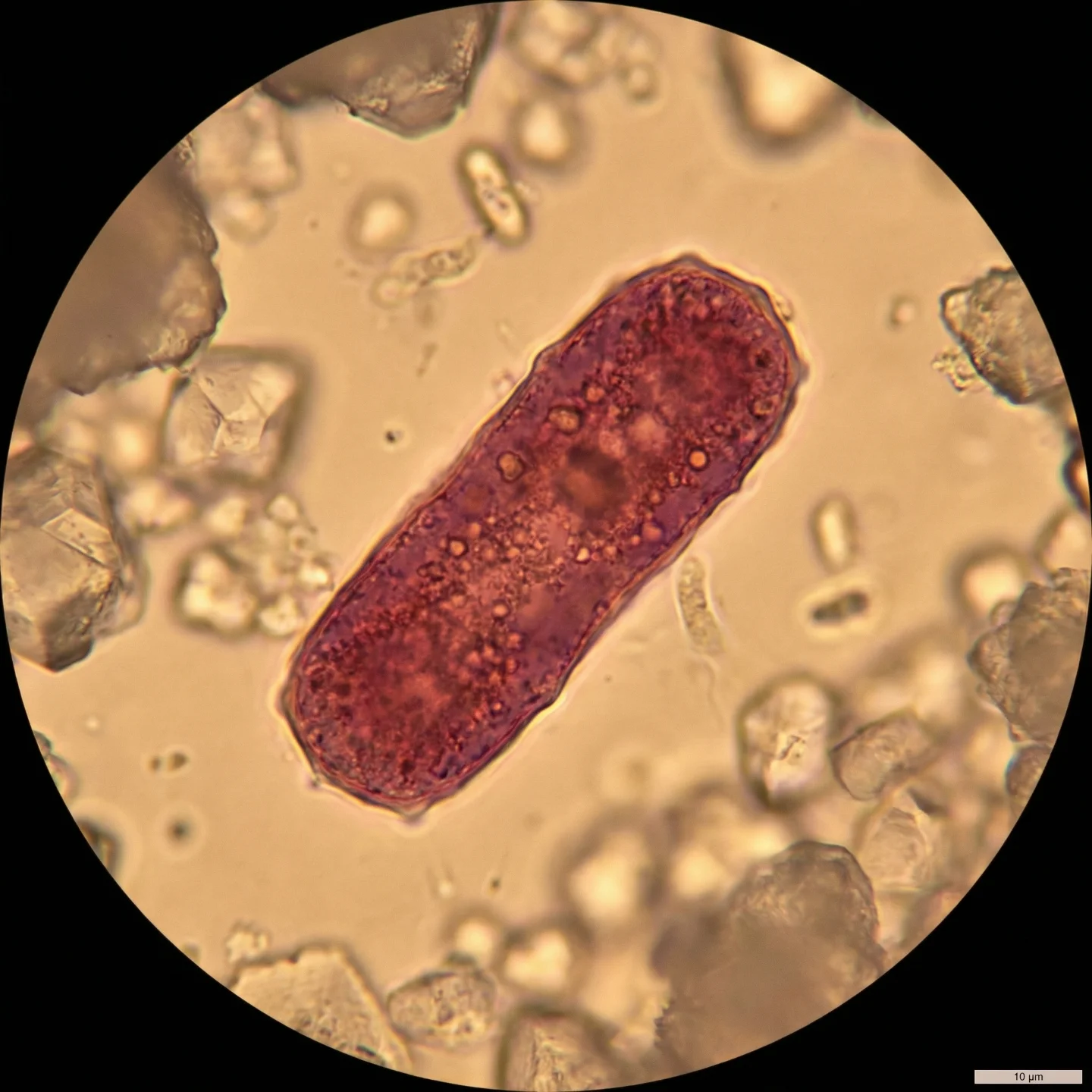 호염성 고세균 (Halophilic archaea (class Halobacteria))
